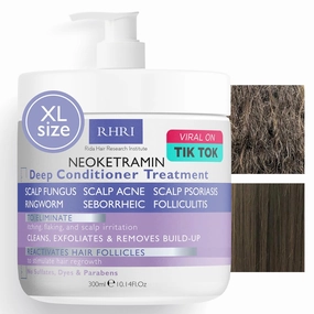 Anti Fungal Deep Conditioner for Men and Women | Scalp Treatment for Psoriasis, Dandruff, Seborrheic Dermatitis | Provides Relief from Folliculitis, Eczema, Itchy , Flaky and Dry Scalp
