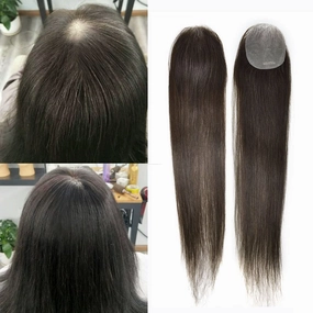 Bald Spot Hair Patch Toupee for Women Men Full Skin Base Human Hair Patch for Bald Spot Non-Surgical V-Looped Hair Replacement Black Brown Hairpiece 14"" #2 Darkest Brown-100% density
