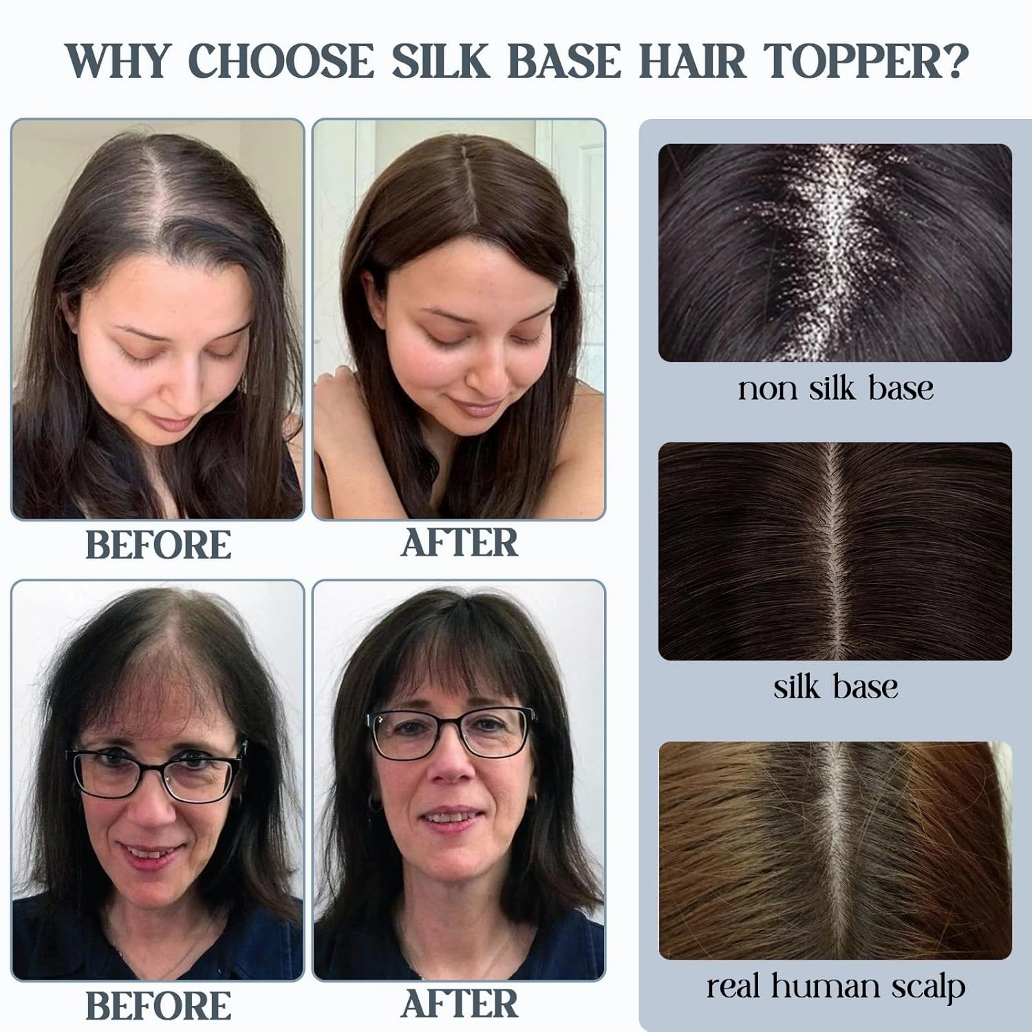 Benehair Hair Toppers for Women Real Human Hair With Bangs 150% Density Remy Human Hair 7 * 13 CM Silk Base Clip in Hair Pieces for Women with Thinning Hair 6 Inch #4 Medium Brown