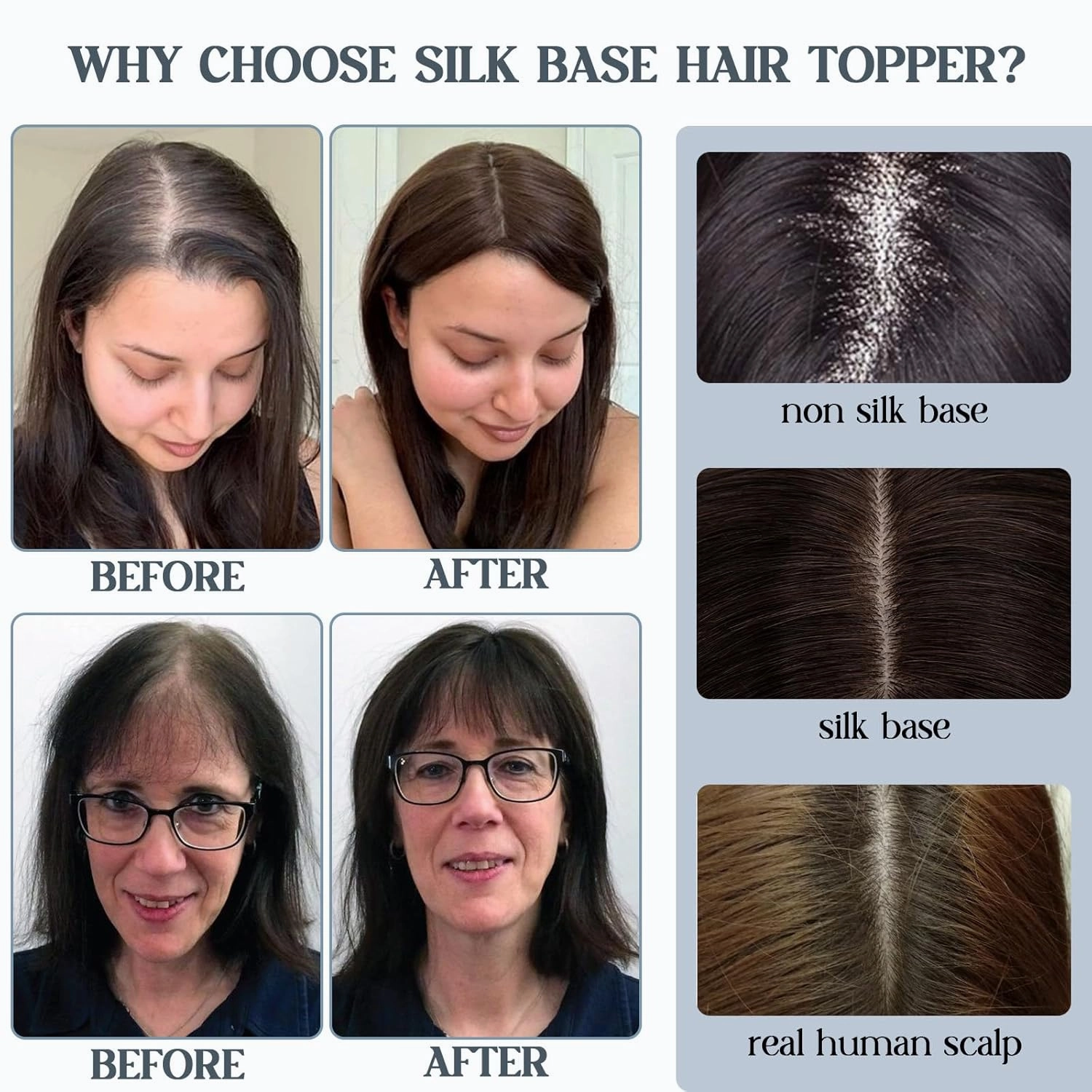 Benehair Human Hair Toppers for Women 100% Remy Human Hair 150% Density No Bangs 7 * 13 CM Silk Base Clip in Hair Pieces for Women 6 Inch #2 Dark Brown