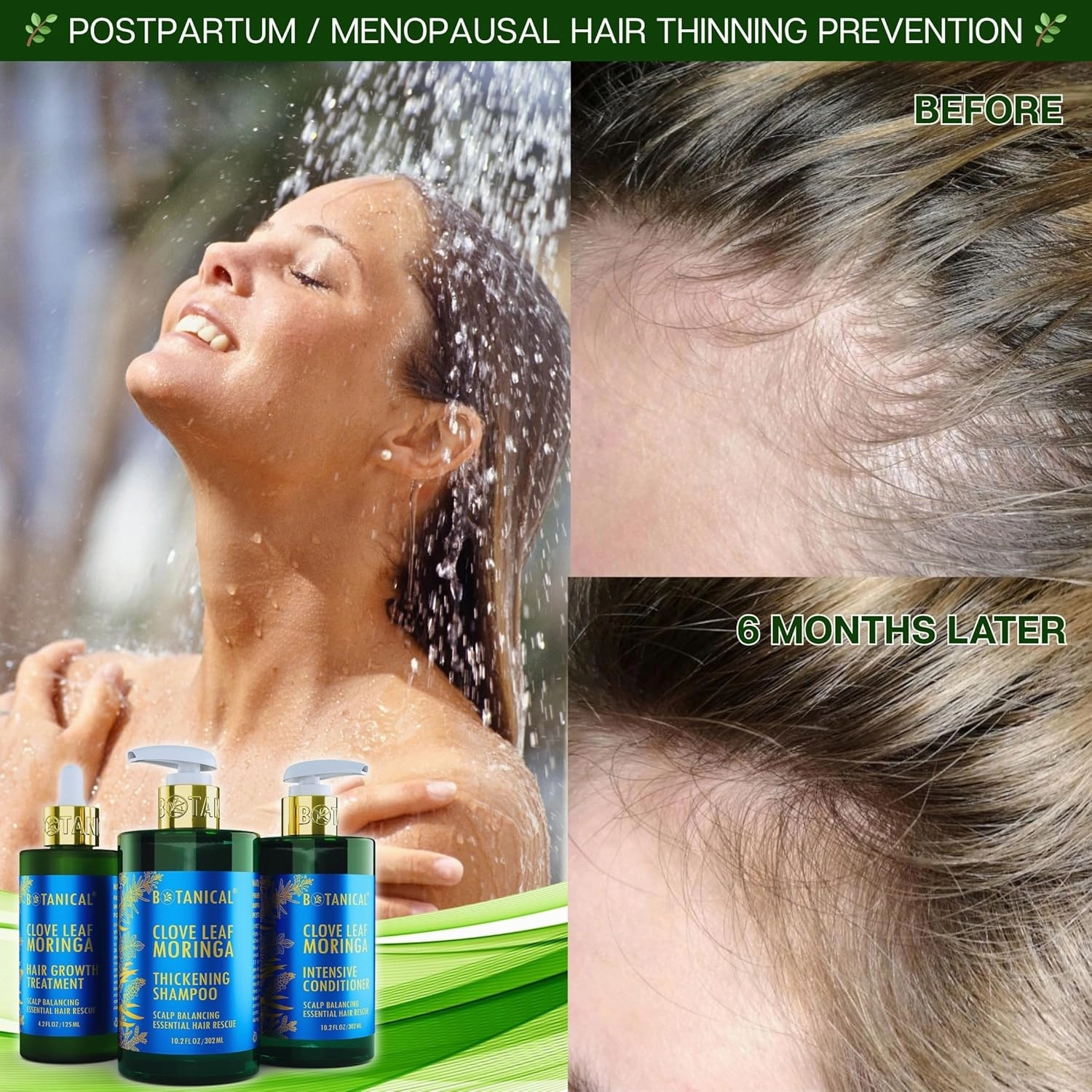 Botanical Hair Growth Treatment Clove Leaf Moringa Hair Oil For Hair Thinning Prevention Pre-Shampoo Scalp Stimulating Detox Head Spa Natural Anti-Hair Loss Thickening Products With Biotin 4.2 Fl Oz