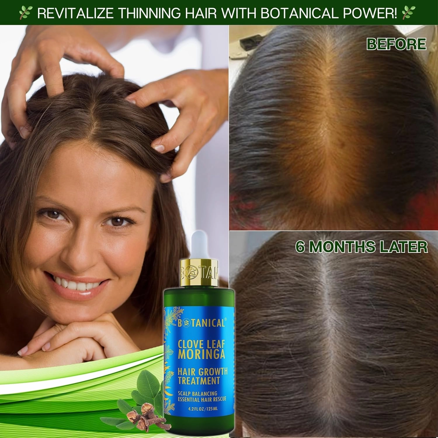 Botanical Hair Growth Treatment Clove Leaf Moringa Hair Oil For Hair Thinning Prevention Pre-Shampoo Scalp Stimulating Detox Head Spa Natural Anti-Hair Loss Thickening Products With Biotin 4.2 Fl Oz
