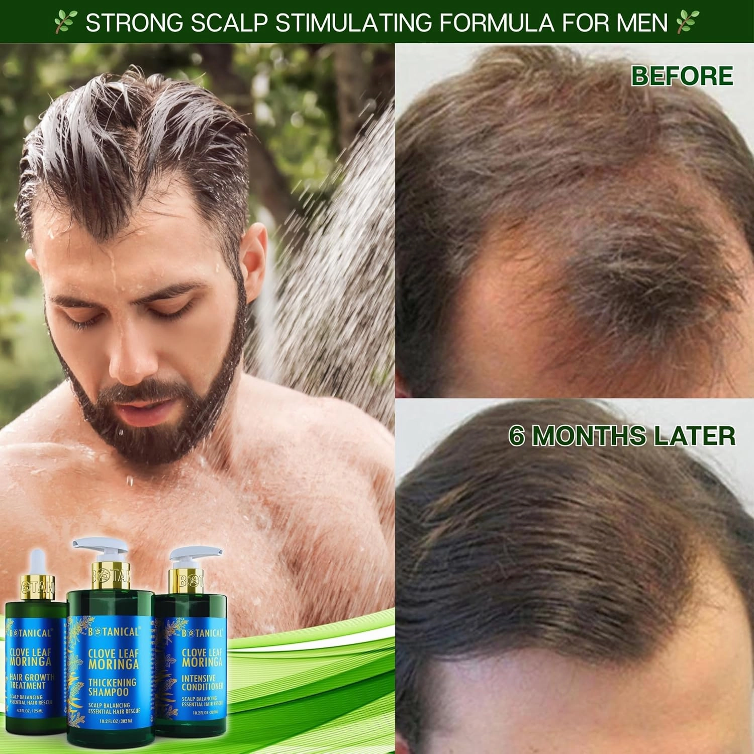 Botanical Hair Growth Treatment Clove Leaf Moringa Hair Oil For Hair Thinning Prevention Pre-Shampoo Scalp Stimulating Detox Head Spa Natural Anti-Hair Loss Thickening Products With Biotin 4.2 Fl Oz