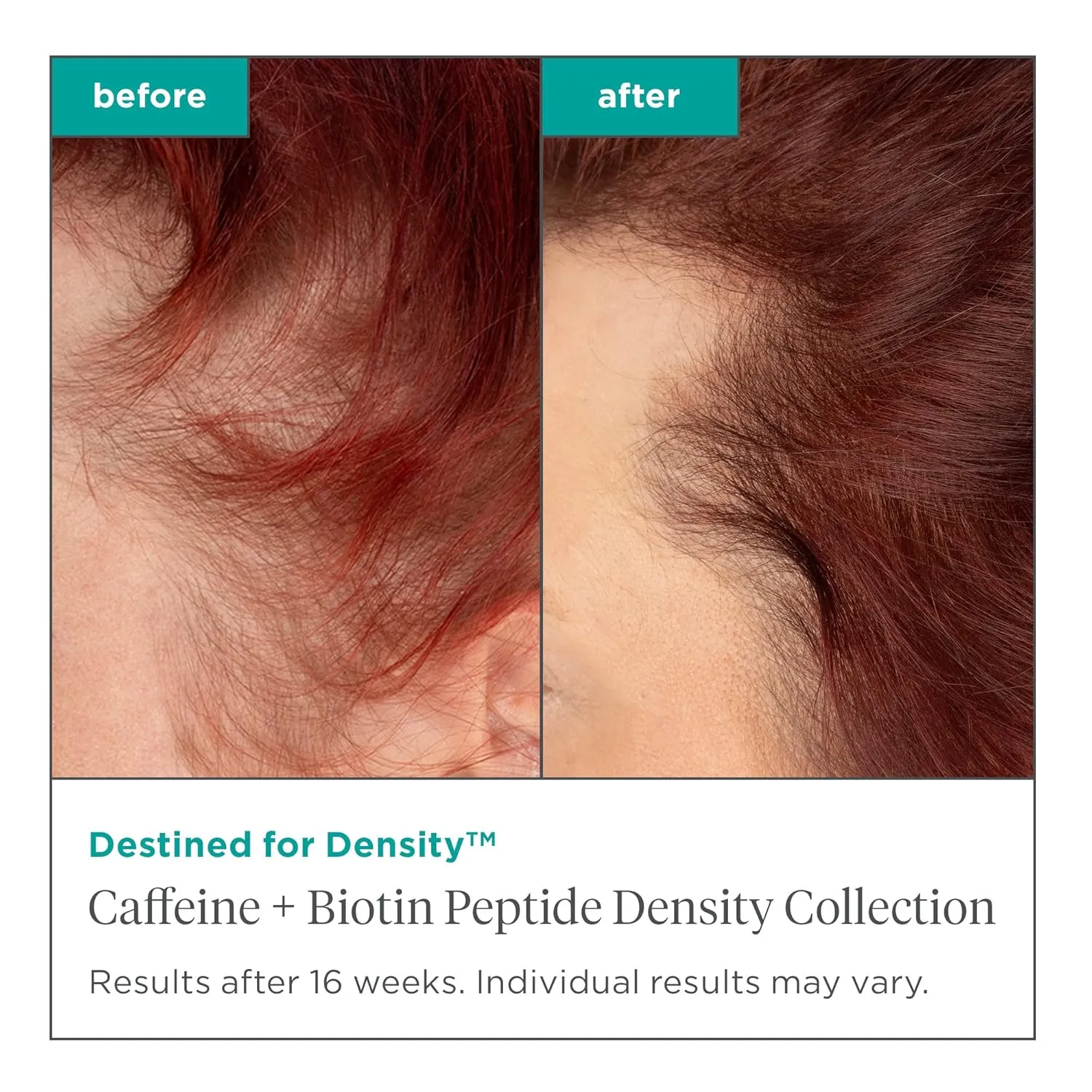 Briogeo Destined For Density Caffeine   Biotin Peptide Density Conditioner, Increases Hair Thickness and Density for Fine or Thinning Hair, Vegan, Cruelty-Free, 8 fl oz