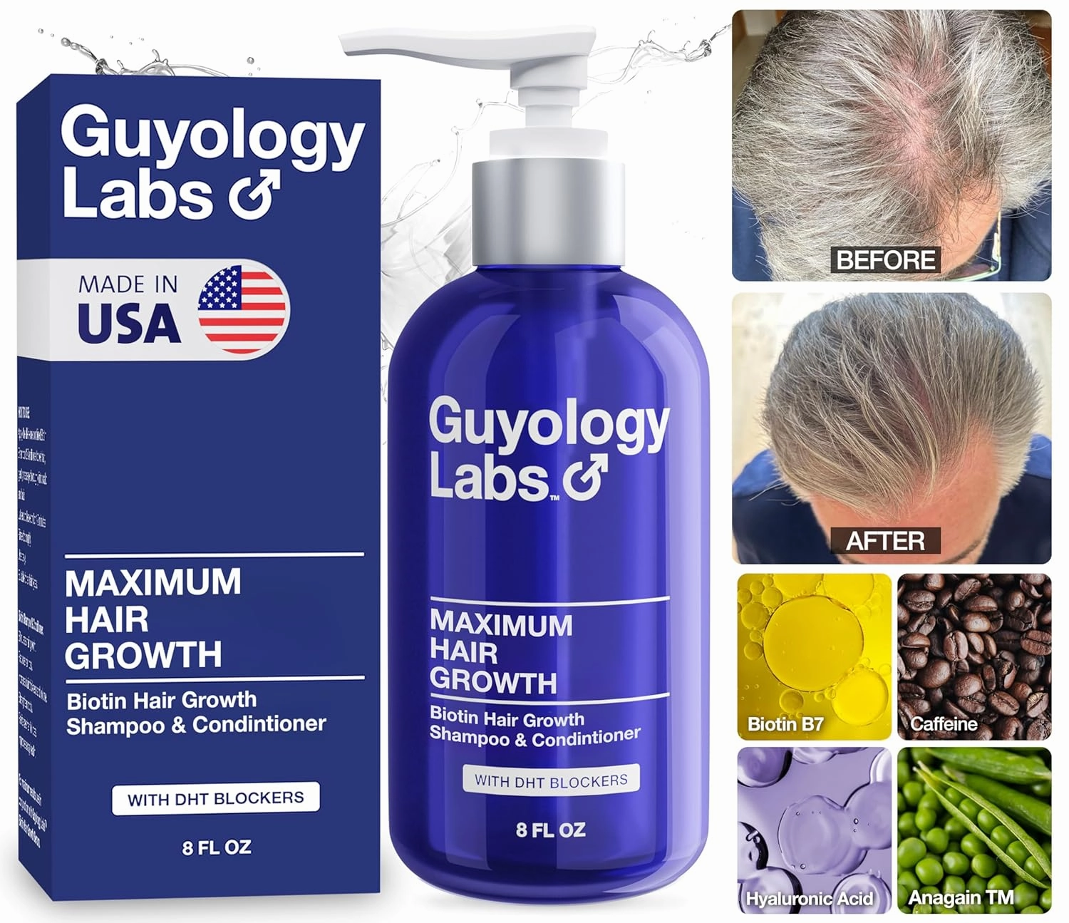Hair Growth Shampoo For Men - With Conditioner for Thinning Hair - Natural DHT Blockers To Reduce Hair Loss - Biotin and Keratin Best for Growth and Thickening - Made in USA by Guyology Labs