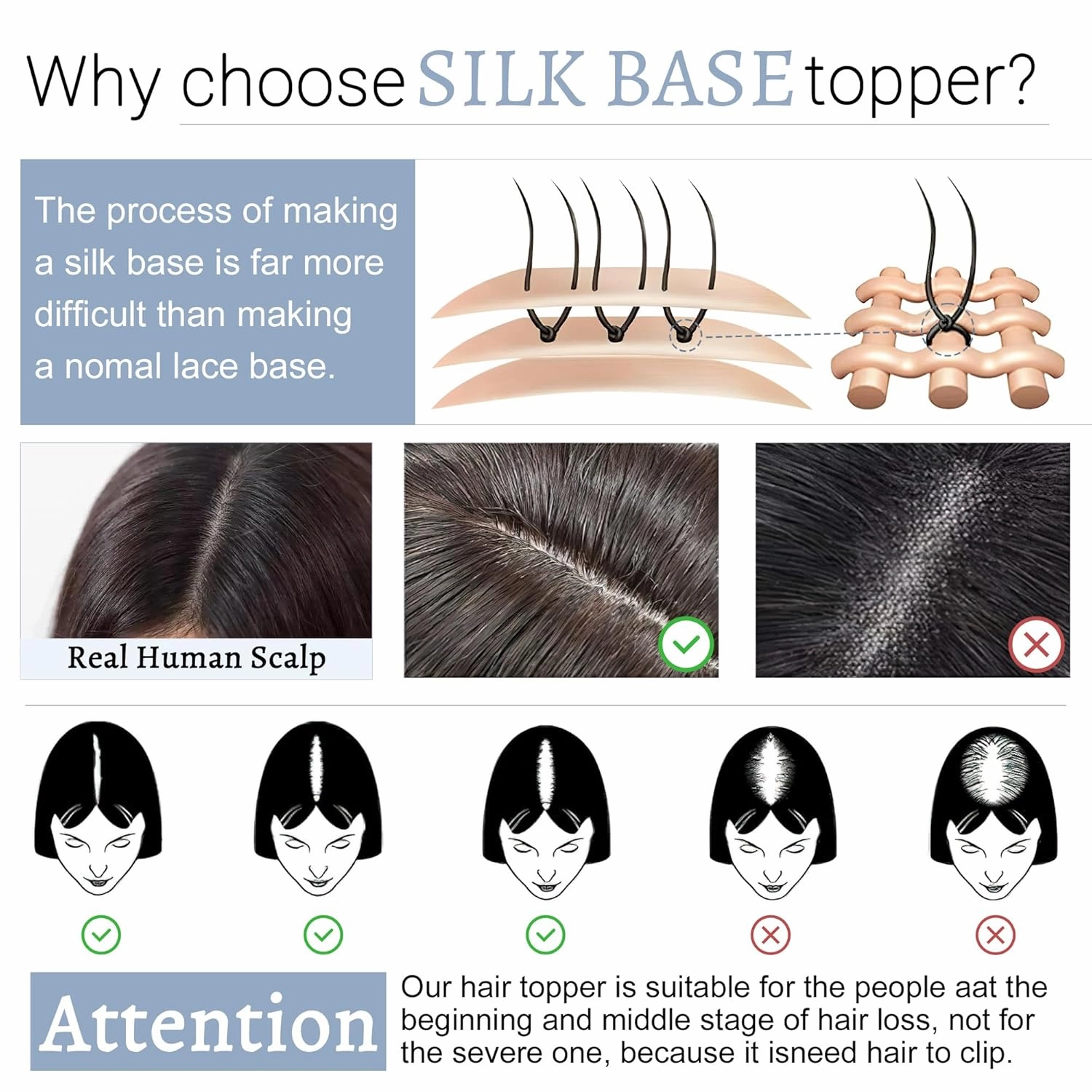 Hair Toppers for Women Real Human Hair With Bangs, 7 * 13 CM Silk Base Clip In Topper Hairpieces, Wiglet Top Pieces Add Volume -8 Inch Dark Brown