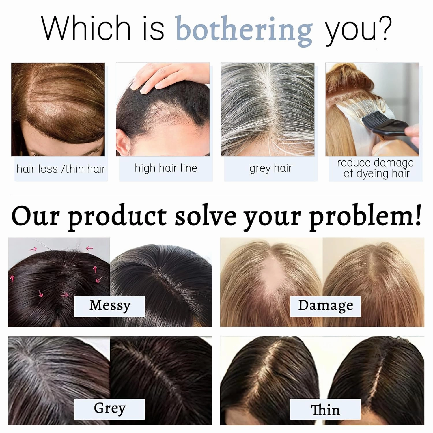 Hair Toppers for Women Real Human Hair With Bangs, 7 * 13 CM Silk Base Clip In Topper Hairpieces, Wiglet Top Pieces Add Volume -8 Inch Dark Brown