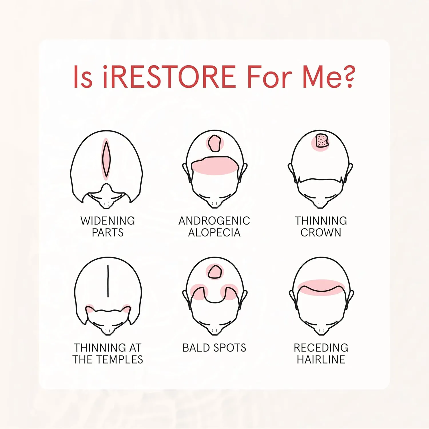 iRestore Anti Hair Loss and Thinning Shampoo - Biotin Formula for Hair Growth, Thickening and Volumizing for Men & Women