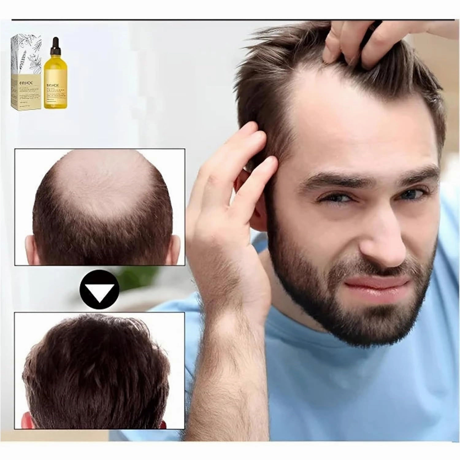 LOVILDS Rosemary Hair Growth Essence, Lovilds Rosemary Hair Growth Oil - 2 Ounce, Rosemary Rosemary Hair & Hair Strengthening Oil for All Hair Types (2 Bottles)