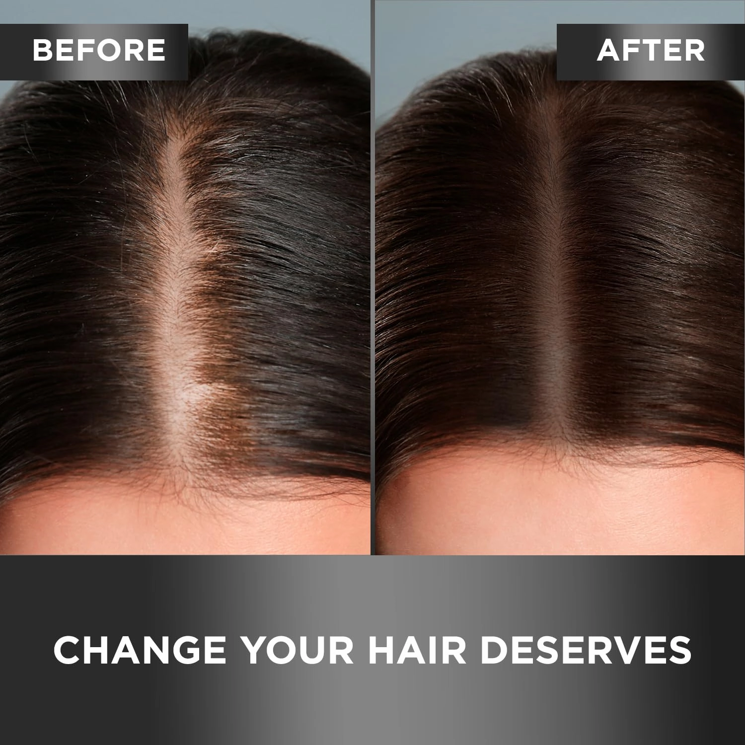 MOEHAIR Travel Trio Pack of Hair Guard Shampoo & Conditioner (3.4 Fl. Oz) with Hair Tonic (0.5 Fl. Oz) | Travel-Friendly | Improves Hair & Scalp Health | Paraben & Sulfate Free