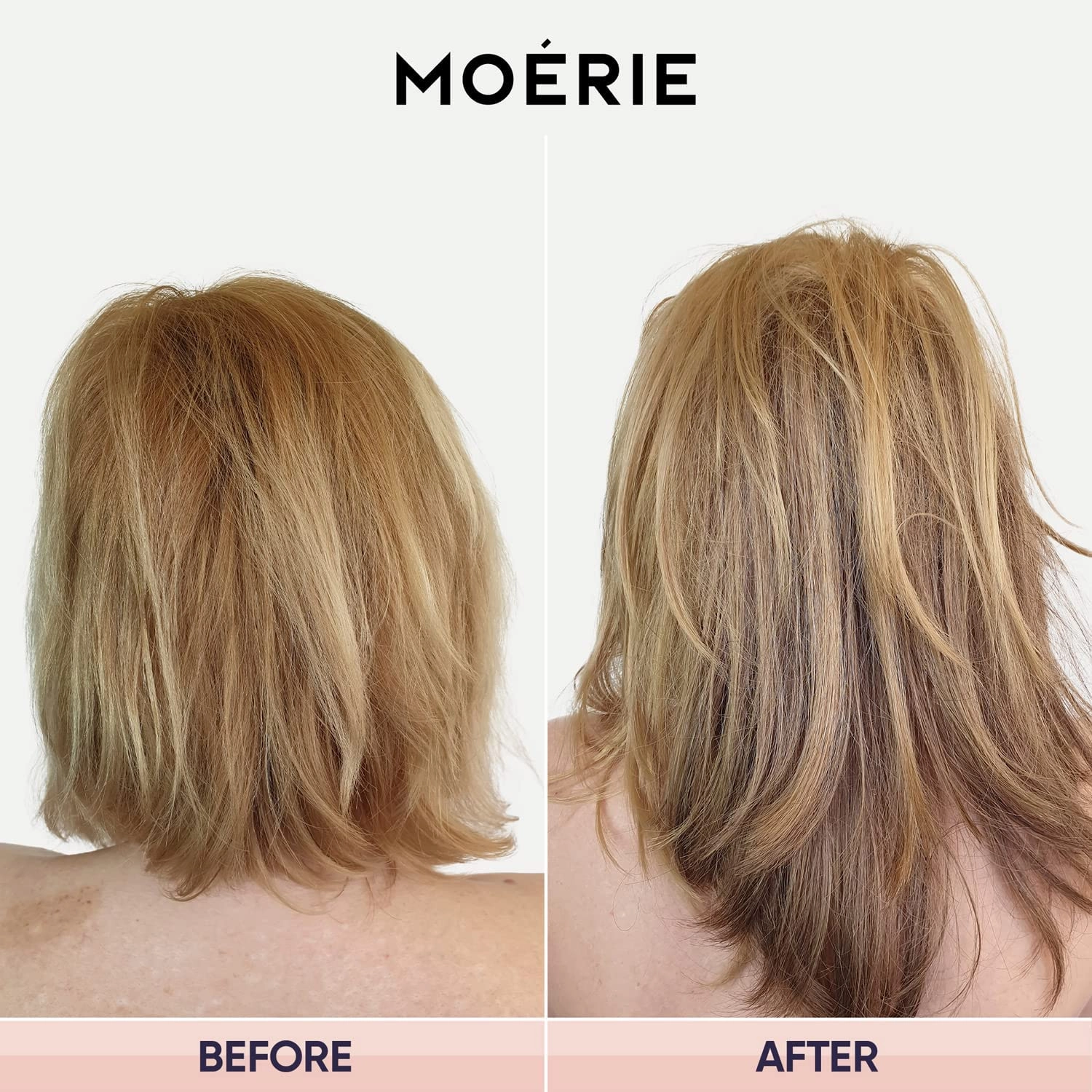 Moerie Ultimate Hair Growth Shampoo – For Longer, Thicker, Fuller Hair - Vegan Friendly Volumizing Hair Products – Paraben & Silicone Free – All Hair Types – Reverse Hair Loss – 8.45 fl oz, Double Set